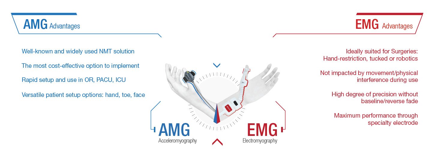 AMG vs. EMG Vorteile2