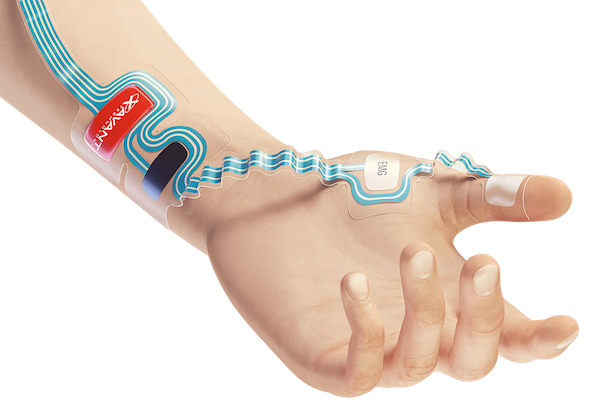 EMG-on-arm-square-small